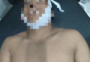 Korban Terbaring di Rumah Sakit