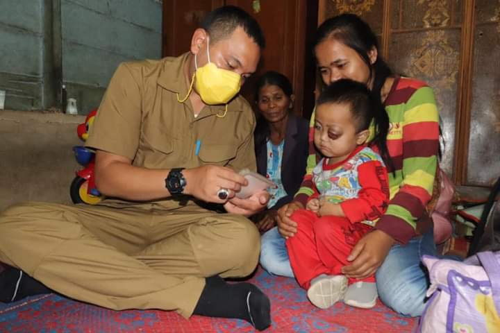 Anak Penderita Tumor Mata Dapat Perhatian Dari Bupati Pakpak Bharat