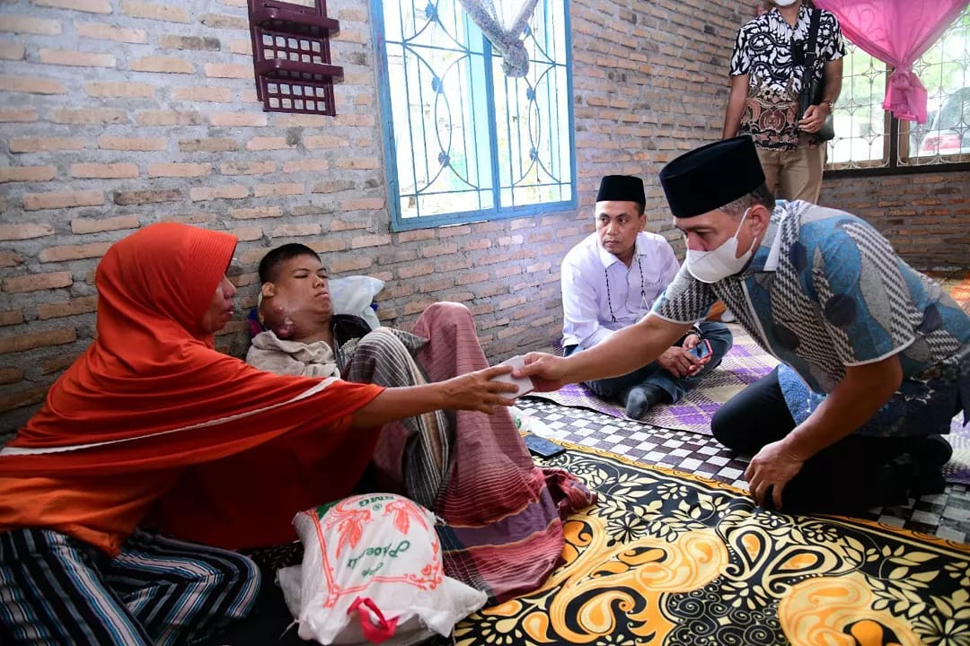 Bupati Bersama Ketua DPRD Batubara Bantu Pengobatan Pemuda Mengidap Kanker Leher