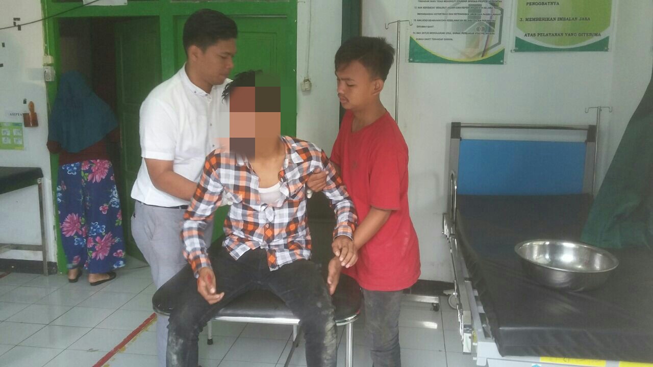 Tampak Pengendara Motor CBR 150 mengalami Luka-luka