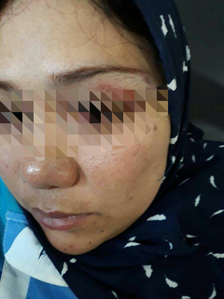 Yuli Setiawati korban pemukulan kepala sekolah