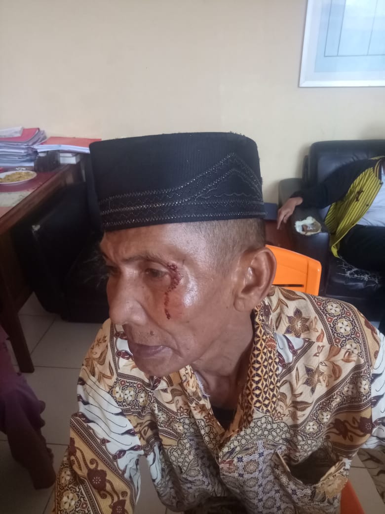 Korban Alami Luka di Bagian Pelipis Kiri