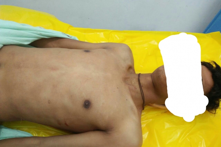 Tampak jenazah Tanpa Identitas Berada di Kamar Jenazah 