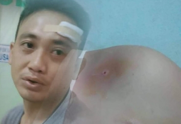 Korban Pemukulan Dekiy