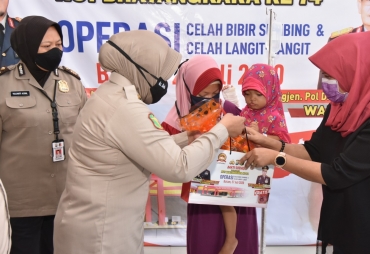 RS Bhayangkara Batam Gelar Operasi Bibir Sumbing