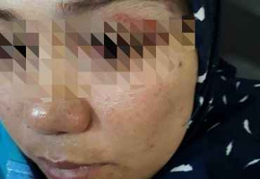 Yuli Setiawati korban pemukulan kepala sekolah